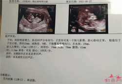 上海专业的代孕包性别哪里好，完成试管取卵之后女性要多吃什么？