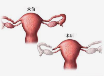 上海代怀男孩子~上海专业供卵机构地址，孕期腰痛很难受 5个妙招来帮忙